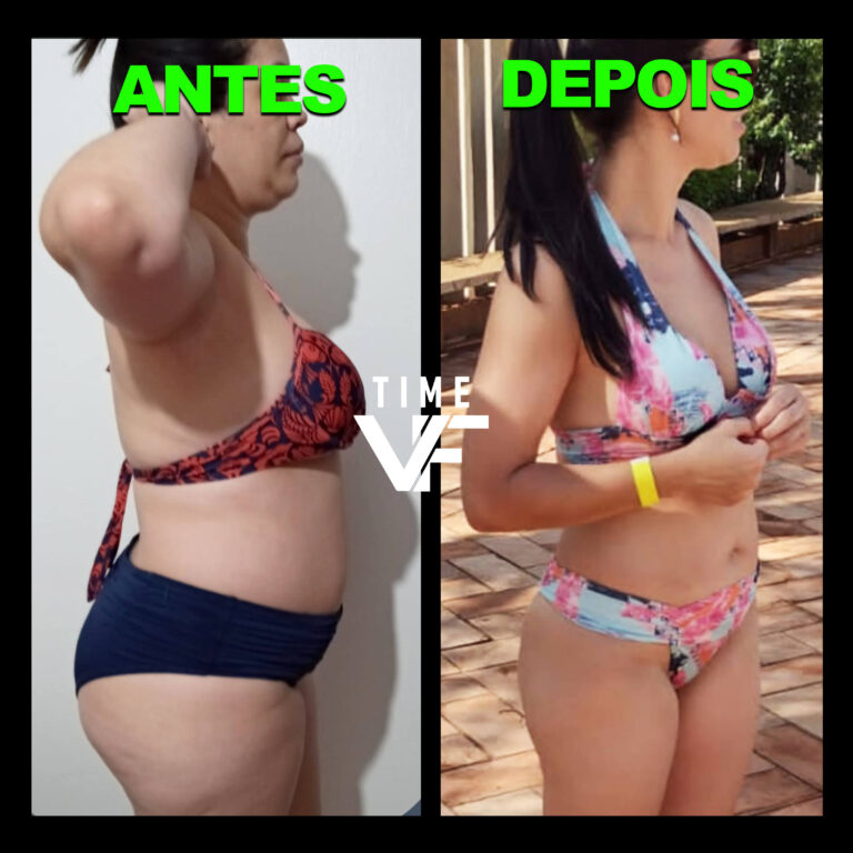 Antes e Depois - Time VF