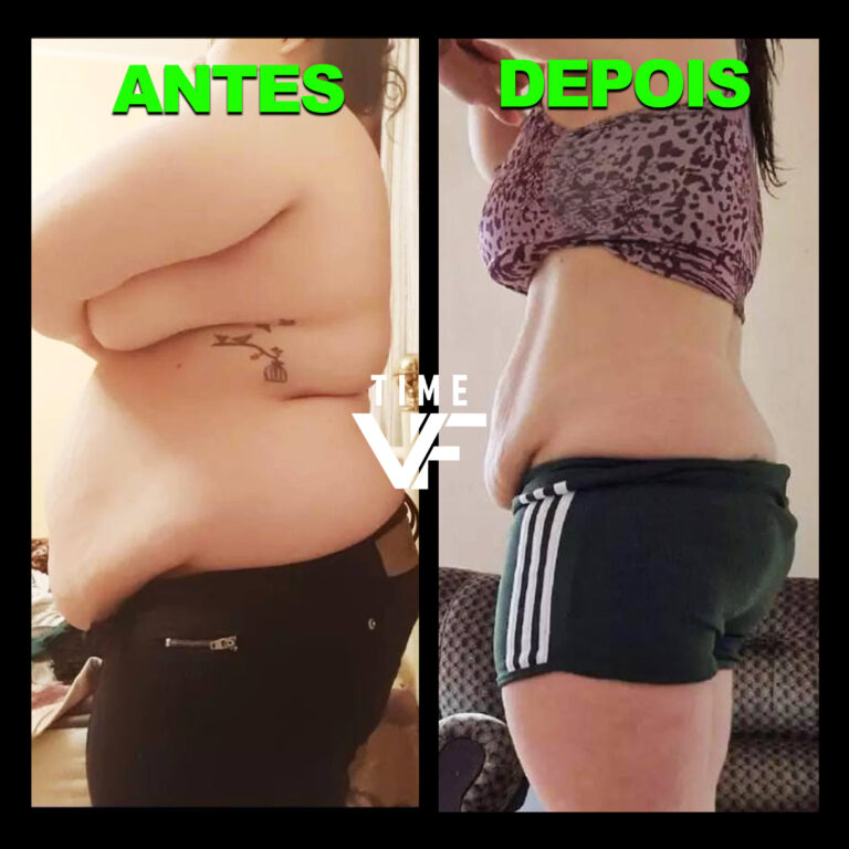 Antes e Depois - Time VF