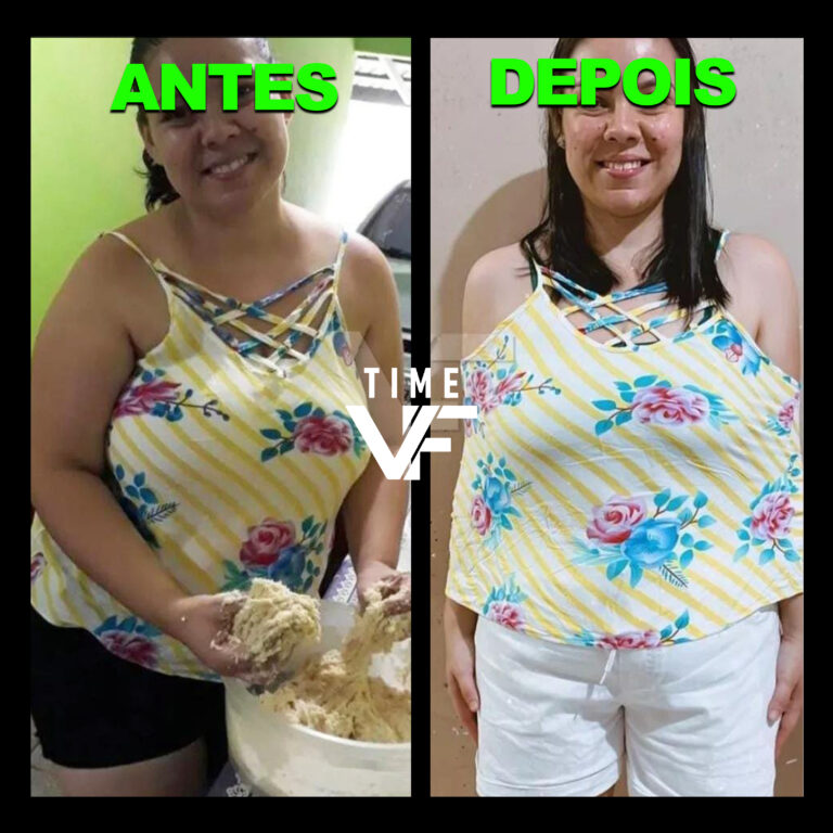 Antes e Depois - Time VF